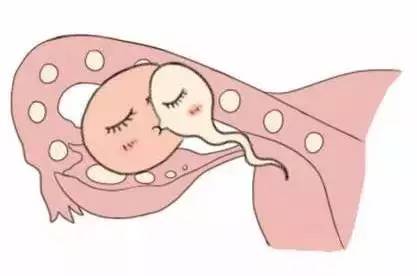 代生选性别供卵代生医院
